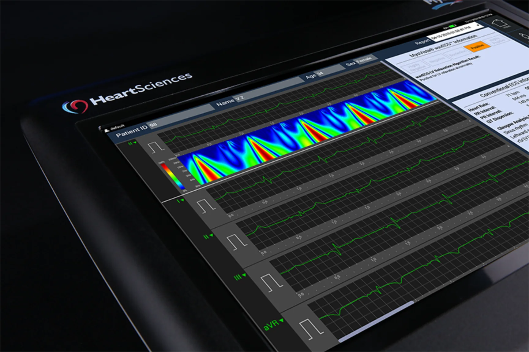 MyoVista wavECG device, three-quarter view