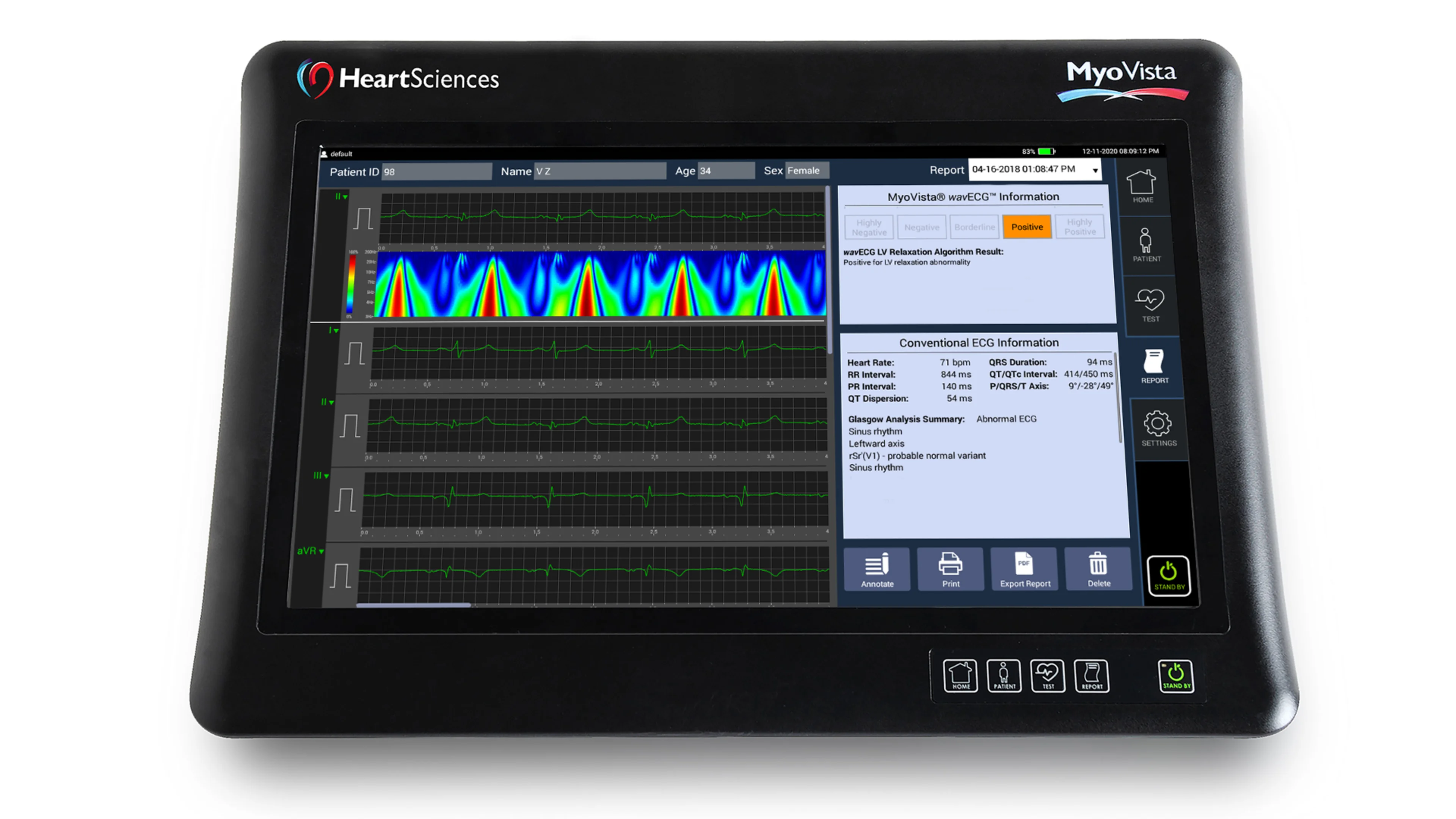 MyoVista wavECG device front view